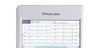 alat perekam detak jantung ECG