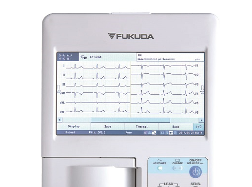 alat perekam detak jantung ECG